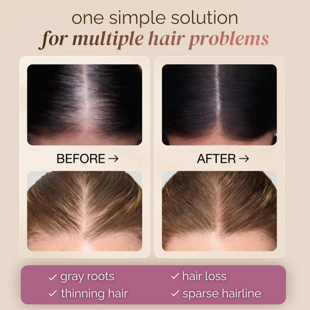 Instant Hairline & Root Concealer – 2-Piece Duo