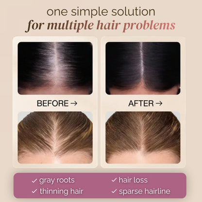 Instant Hairline & Root Concealer – 2-Piece Duo